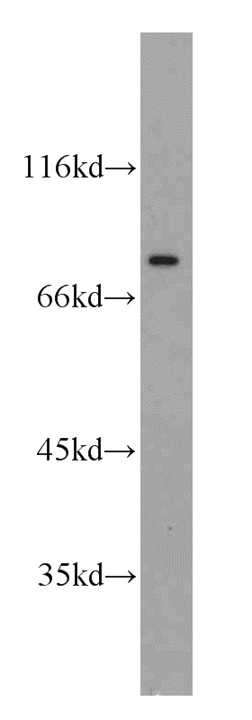 HeLa cells were subjected to SDS PAGE followed by western blot with Catalog No:113384(NUP88 antibody) at dilution of 1:300