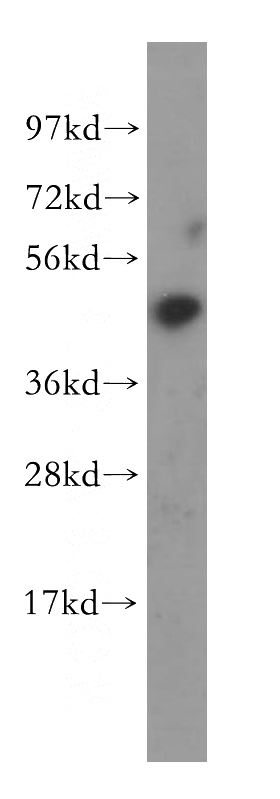 HeLa cells were subjected to SDS PAGE followed by western blot with Catalog No:117103(BCL7B antibody) at dilution of 1:400