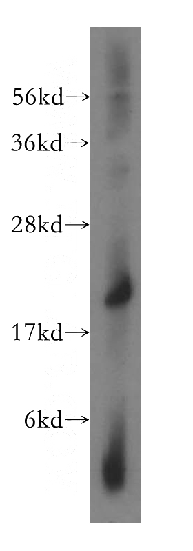 human brain tissue were subjected to SDS PAGE followed by western blot with Catalog No:109954(DNAL1 antibody) at dilution of 1:500