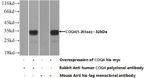 Transfected HEK-293 cells were subjected to SDS PAGE followed by western blot with Catalog No:109469(COQ4 Antibody) at dilution of 1:700