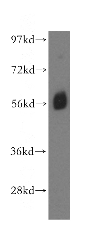 human kidney tissue were subjected to SDS PAGE followed by western blot with Catalog No:108418(BANP antibody) at dilution of 1:500