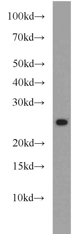 mouse brain tissue were subjected to SDS PAGE followed by western blot with Catalog No:108902(CBLN2 antibody) at dilution of 1:800