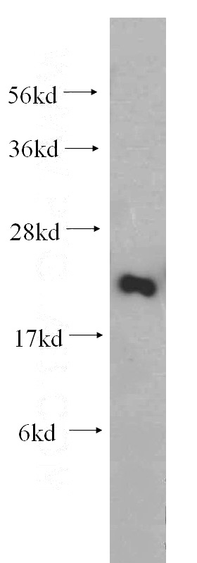 mouse ovary tissue were subjected to SDS PAGE followed by western blot with Catalog No:114837(RPS26 antibody) at dilution of 1:200