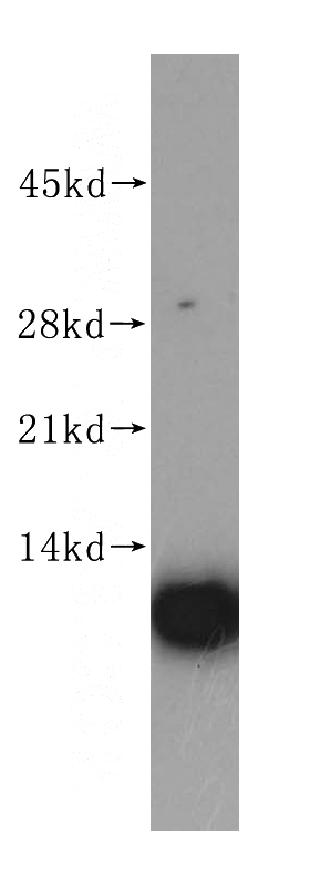 MCF7 cells were subjected to SDS PAGE followed by western blot with Catalog No:114893(RPL37A antibody) at dilution of 1:400