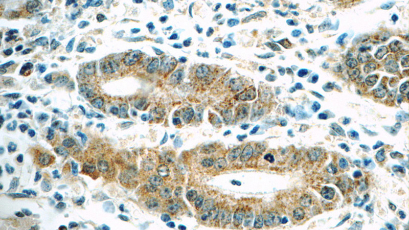 Immunohistochemistry of paraffin-embedded human stomach tissue slide using Catalog No:112808(MRPL1 Antibody) at dilution of 1:50 (under 40x lens)
