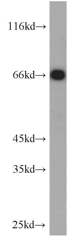 mouse liver tissue were subjected to SDS PAGE followed by western blot with Catalog No:112161(LBP antibody) at dilution of 1:1000