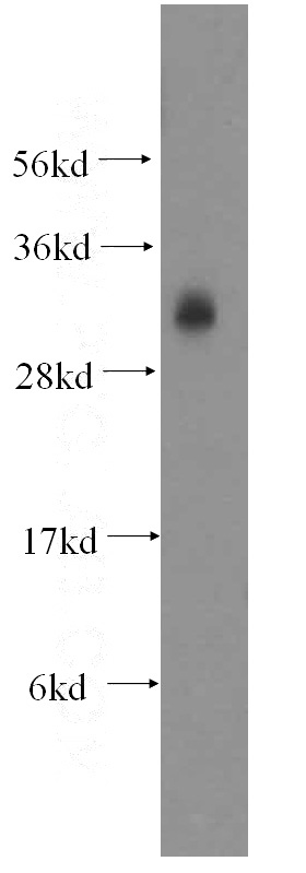 mouse testis tissue were subjected to SDS PAGE followed by western blot with Catalog No:115355(SLD5 antibody) at dilution of 1:400