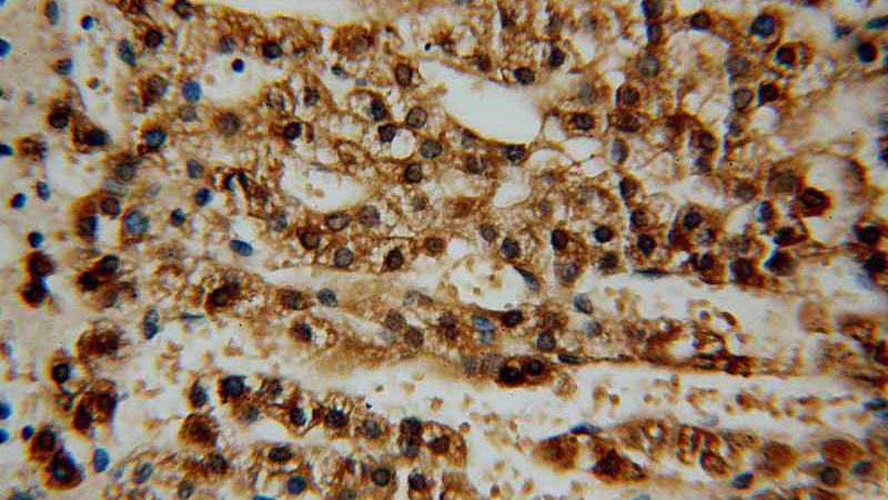Immunohistochemical of paraffin-embedded human adrenal gland using Catalog No:107970(ALDH3B2 antibody) at dilution of 1:50 (under 40x lens)