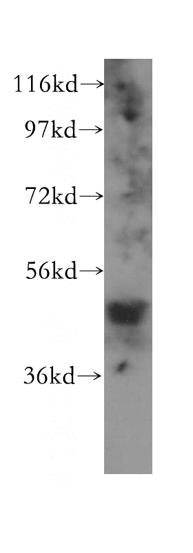 HeLa cells were subjected to SDS PAGE followed by western blot with Catalog No:110741(FNTB antibody) at dilution of 1:500