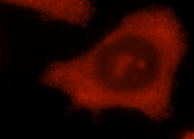 Immunofluorescent analysis of MCF-7 cells, using CHAC2 antibody Catalog No:109205 at 1:25 dilution and Rhodamine-labeled goat anti-rabbit IgG (red).