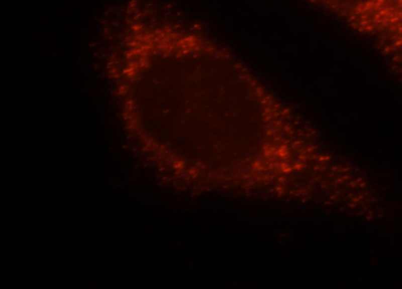 Immunofluorescent analysis of Hela cells, using HSD17B4 antibody Catalog No:111547 at 1:25 dilution and Rhodamine-labeled goat anti-rabbit IgG (red).