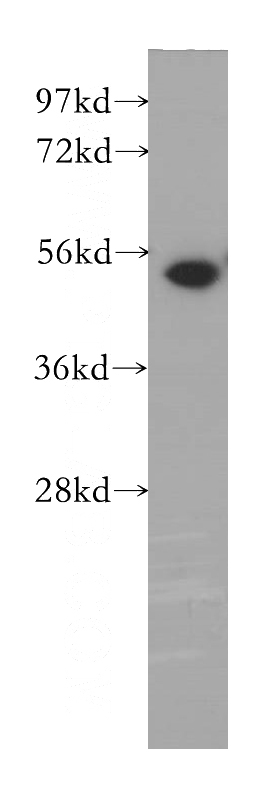 HEK-293 cells were subjected to SDS PAGE followed by western blot with Catalog No:112622(MINA antibody) at dilution of 1:500