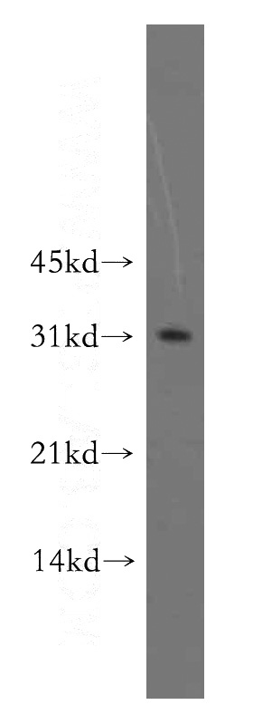 K-562 cells were subjected to SDS PAGE followed by western blot with Catalog No:113979(PNMT antibody) at dilution of 1:400