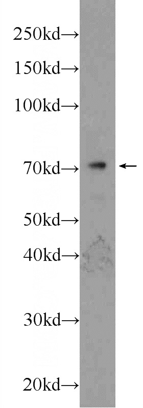 mouse lung tissue were subjected to SDS PAGE followed by western blot with Catalog No:115905(TCF4 Antibody) at dilution of 1:600