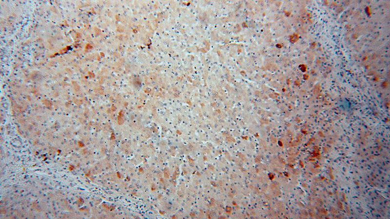 Immunohistochemical of paraffin-embedded human liver using Catalog No:112574(ME1 antibody) at dilution of 1:100 (under 10x lens)