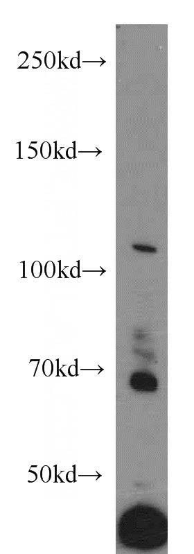 HEK-293 cells were subjected to SDS PAGE followed by western blot with Catalog No:114674(RECK antibody) at dilution of 1:600