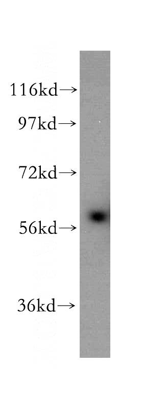 mouse thymus tissue were subjected to SDS PAGE followed by western blot with Catalog No:109045(IL7R antibody) at dilution of 1:1500