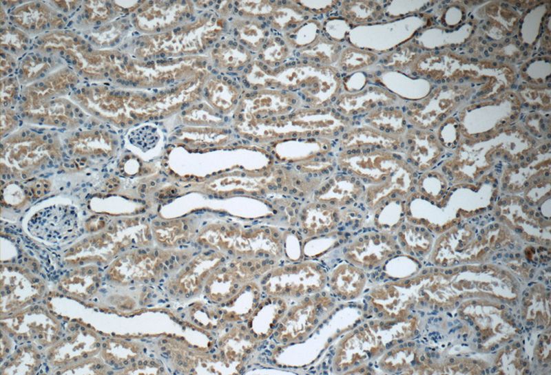 Immunohistochemistry of paraffin-embedded human kidney tissue slide using Catalog No:115745(SHoc2 Antibody) at dilution of 1:50 (under 10x lens)