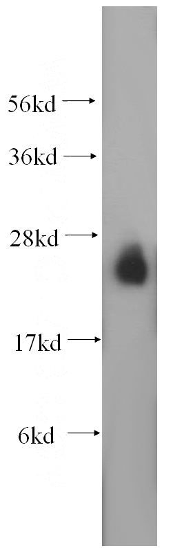mouse brain tissue were subjected to SDS PAGE followed by western blot with Catalog No:114439(RAB3A antibody) at dilution of 1:1000