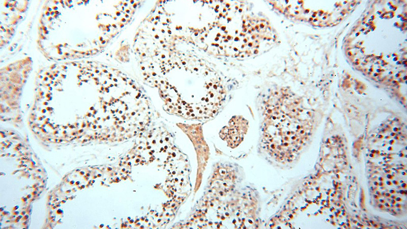 Immunohistochemical of paraffin-embedded human testis using Catalog No:115956(TEX11 antibody) at dilution of 1:100 (under 10x lens)