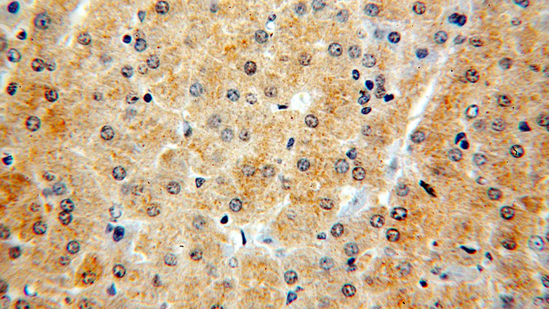 Immunohistochemical of paraffin-embedded human liver using Catalog No:114412(RAB12 antibody) at dilution of 1:100 (under 40x lens)