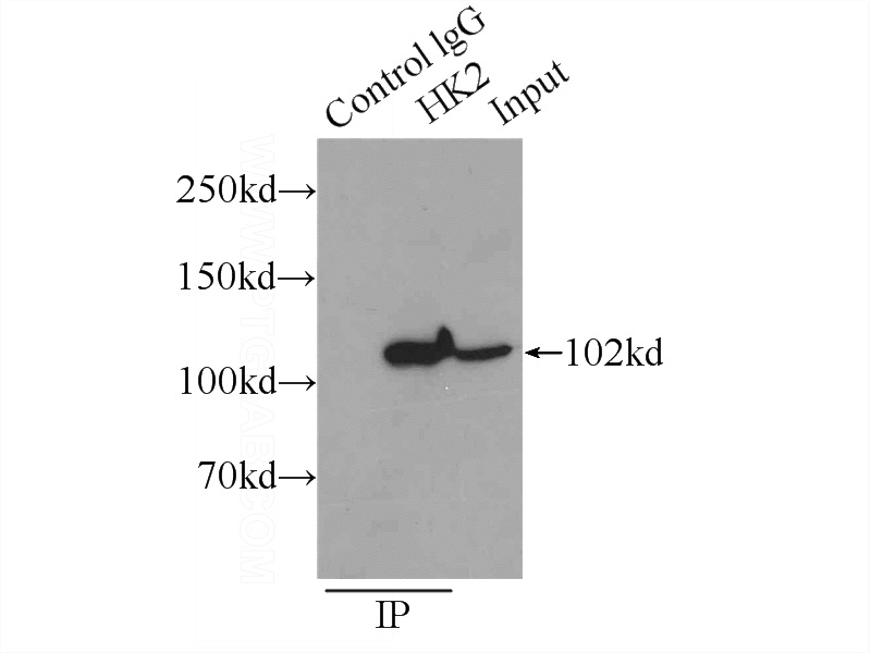 IP Result of anti-HK2 (IP:Catalog No:111307, 3ug; Detection:Catalog No:111307 1:1000) with HeLa cells lysate 2000ug.
