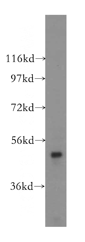 mouse testis tissue were subjected to SDS PAGE followed by western blot with Catalog No:107833(AGPAT6 antibody) at dilution of 1:400