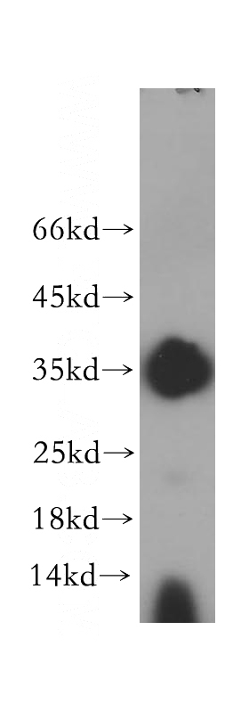 HeLa cells were subjected to SDS PAGE followed by western blot with Catalog No:115320(SLC25A1 antibody) at dilution of 1:400