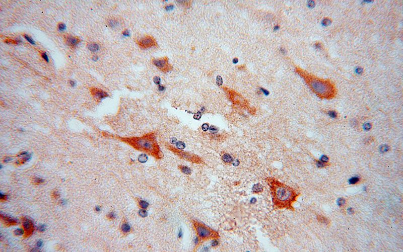 Immunohistochemical of paraffin-embedded human brain using Catalog No:114873(RPL18A antibody) at dilution of 1:100 (under 40x lens)