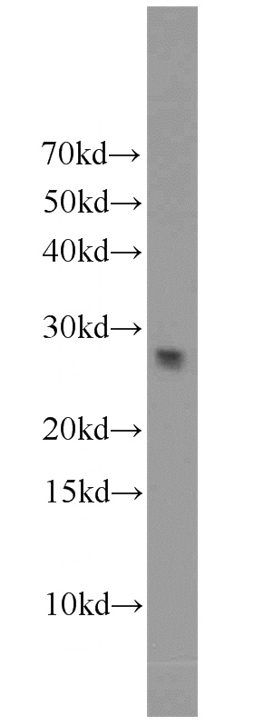 NIH/3T3 cells were subjected to SDS PAGE followed by western blot with Catalog No:112707(MMP7 antibody) at dilution of 1:800