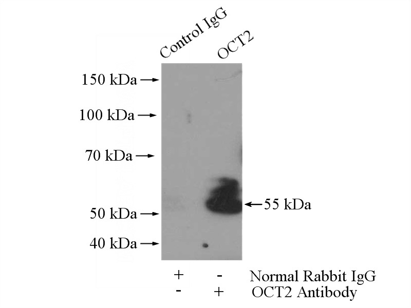 IP Result of anti-POU2F2 (IP:Catalog No:113470, 4ug; Detection:Catalog No:113470 1:300) with NIH/3T3 cells lysate 1200ug.