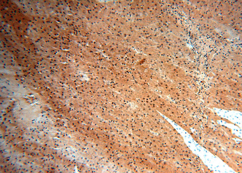 Immunohistochemical of paraffin-embedded human liver using Catalog No:113269(NR5A1 antibody) at dilution of 1:100 (under 10x lens)