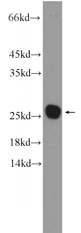 mouse brain tissue were subjected to SDS PAGE followed by western blot with Catalog No:108605(C16orf45 Antibody) at dilution of 1:600