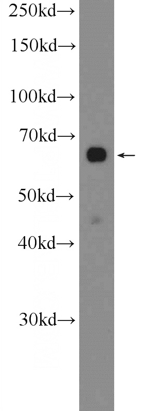 MCF-7 cells were subjected to SDS PAGE followed by western blot with Catalog No:114242(PRR14 Antibody) at dilution of 1:1000