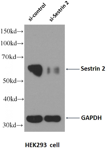 WB result of Sestrin antibody (Catalog No:115218, 1:2000) with si-Control and si-Sestrin transfected HEK293 cells.