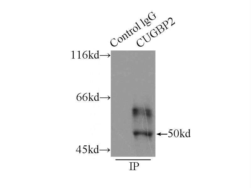 IP Result of anti-CUGBP2 (IP:Catalog No:109740, 3ug; Detection:Catalog No:109740 1:300) with mouse skeletal muscle tissue lysate 7500ug.