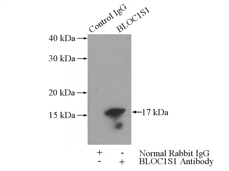 IP Result of anti-BLoc1S1-Specific (IP:Catalog No:117188, 3ug; Detection:Catalog No:117188 1:1000) with mouse brain tissue lysate 4000ug.