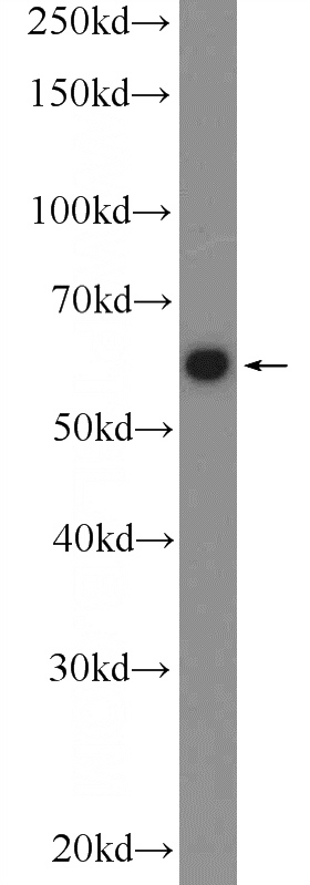 HEK-293 cells were subjected to SDS PAGE followed by western blot with Catalog No:112357(LTA4H Antibody) at dilution of 1:1000