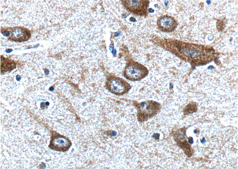 Immunohistochemistry of paraffin-embedded human brain tissue slide using Catalog No:114268(PTGER3 Antibody) at dilution of 1:200 (under 40x lens)