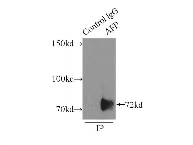 IP Result of anti-AFP (IP:Catalog No:107912, 5ug; Detection:Catalog No:107912 1:1000) with HepG2 cells lysate 6000ug.