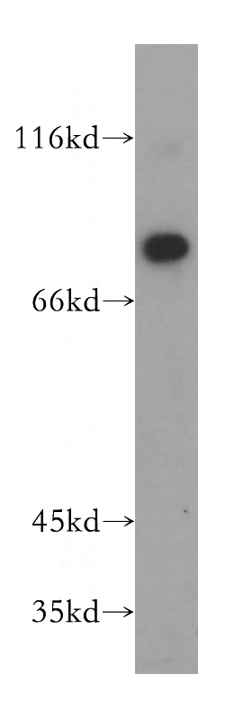 Y79 cells were subjected to SDS PAGE followed by western blot with Catalog No:112147(LARP4 antibody) at dilution of 1:300