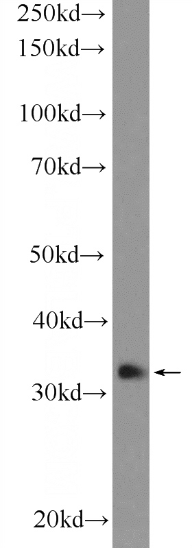 HepG2 cells were subjected to SDS PAGE followed by western blot with Catalog No:111235(GTF2H3 Antibody) at dilution of 1:600