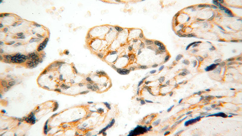 Immunohistochemical of paraffin-embedded human placenta using Catalog No:109812(KRT7-specific antibody) at dilution of 1:100 (under 40x lens)