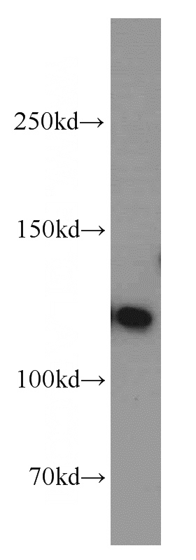 mouse brain tissue were subjected to SDS PAGE followed by western blot with Catalog No:114094(PPP1R9B antibody) at dilution of 1:500