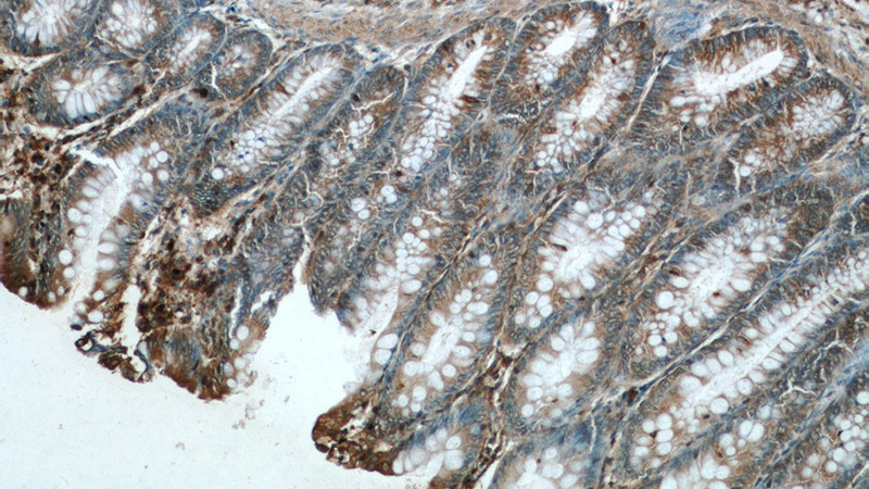 Immunohistochemistry of paraffin-embedded human colon tissue slide using Catalog No:114218(PROK2 Antibody) at dilution of 1:50 (under 10x lens)