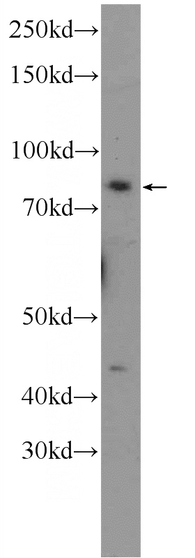 HEK-293 cells were subjected to SDS PAGE followed by western blot with Catalog No:116231(TRAF3IP1 Antibody) at dilution of 1:300