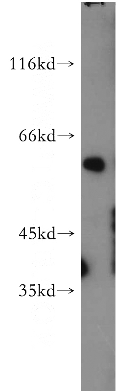 mouse skin tissue were subjected to SDS PAGE followed by western blot with Catalog No:113606(PAX3 antibody) at dilution of 1:500