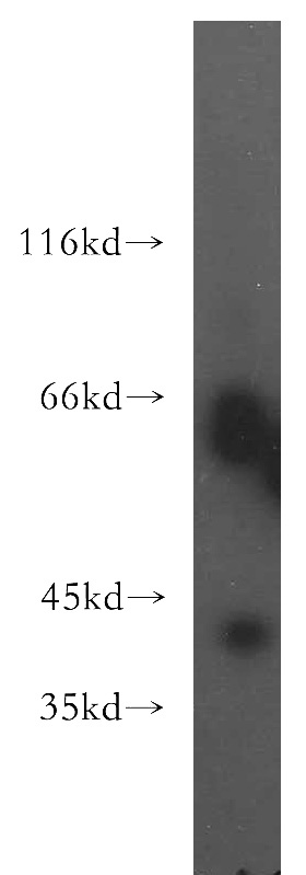 HepG2 cells were subjected to SDS PAGE followed by western blot with Catalog No:116329(TRAM2 antibody) at dilution of 1:500