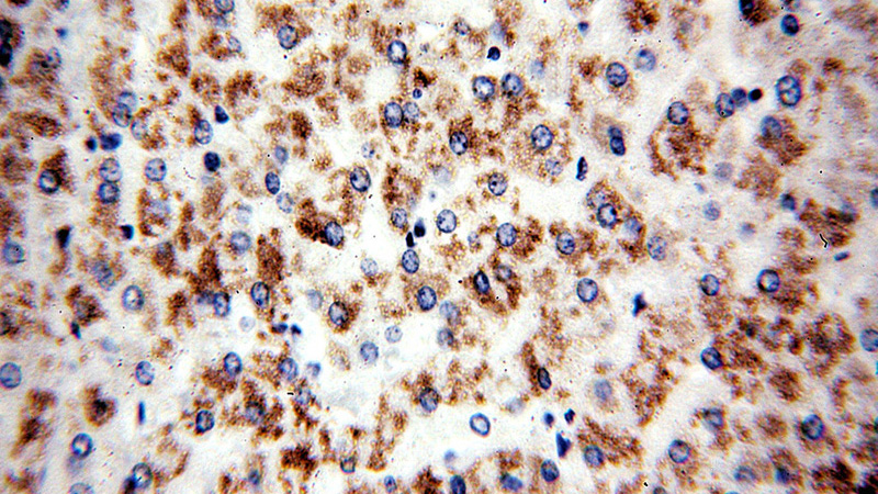 Immunohistochemical of paraffin-embedded human liver using Catalog No:111962(IVD antibody) at dilution of 1:50 (under 40x lens)