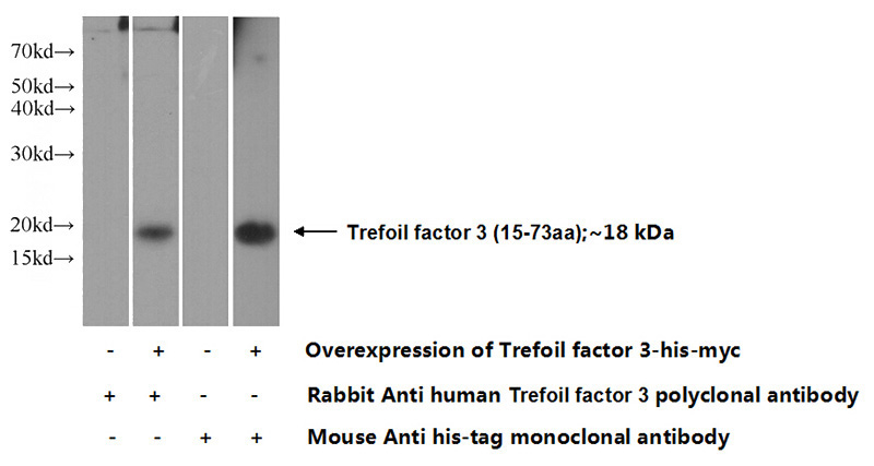 Transfected HEK-293 cells were subjected to SDS PAGE followed by western blot with Catalog No:116355(TFF3 Antibody) at dilution of 1:500